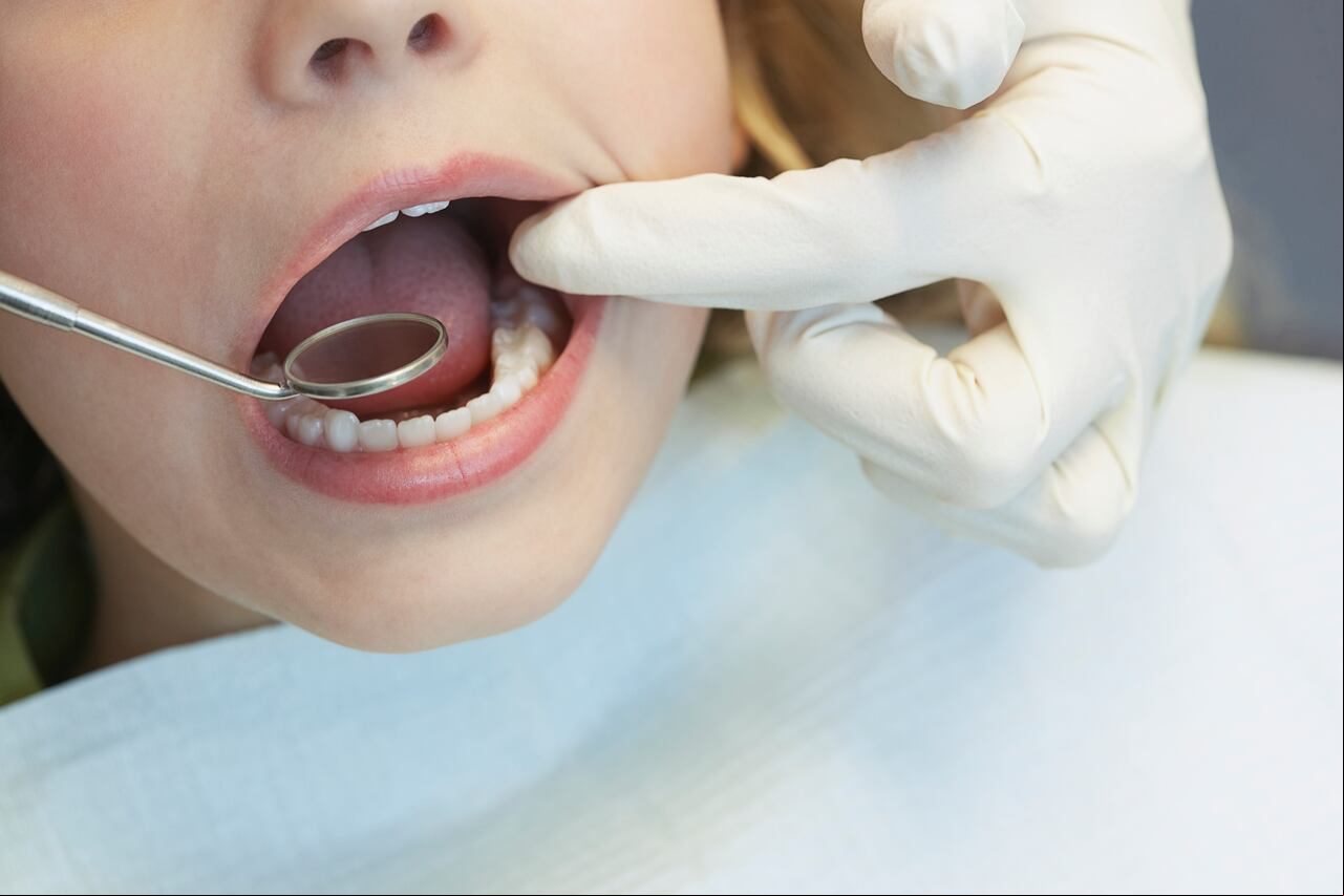 Odontología / Niños / Dientes