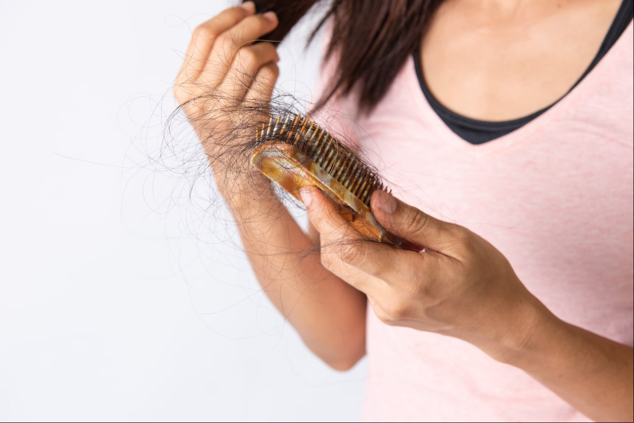 Pérdida de pelo por falta de vitaminas