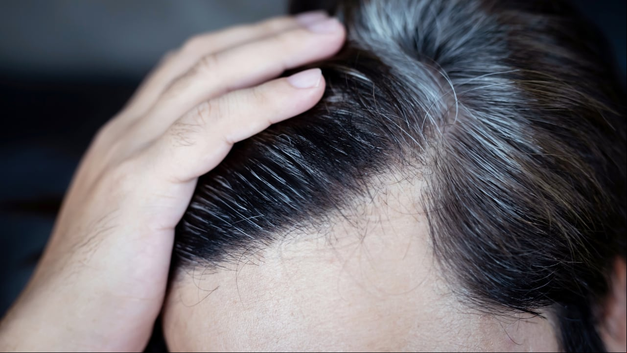 Encuentre inspiración en la sabiduría ancestral: aprenda a utilizar la canela para disimular las canas.