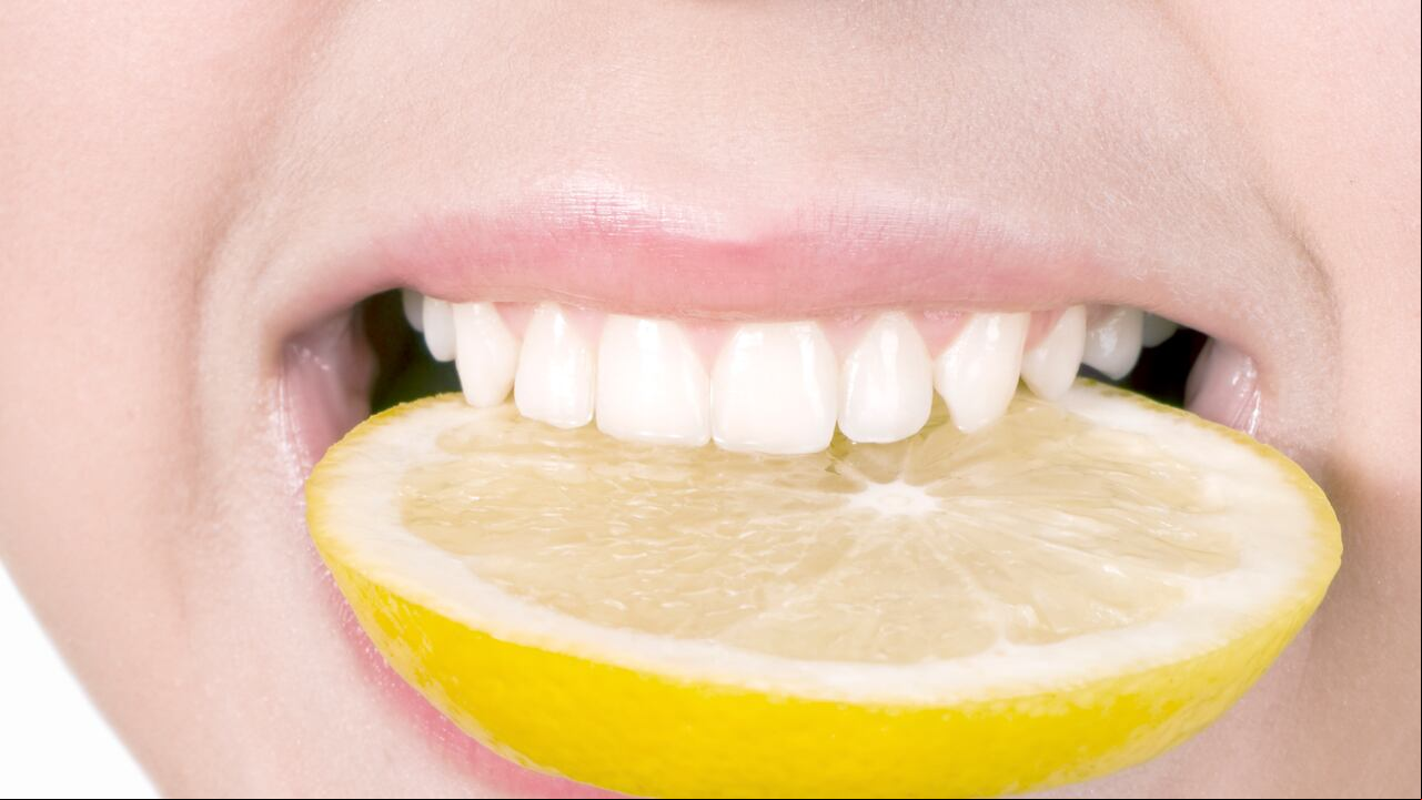 El limón, aunque saludable, puede causar erosión del esmalte dental debido a su alta acidez