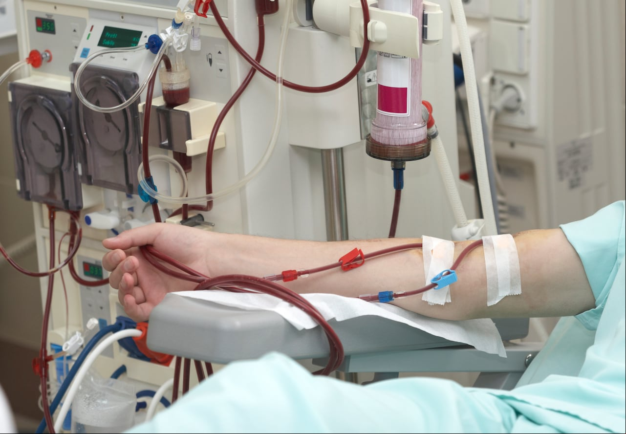 Entre las condiciones más conocidas se encuentran la enfermedad renal crónica, diabetes , el VIH / Sida, la hemofilia y otras coagulopatías, la artritis, la hepatitis C y 11 tipos priorizados de cáncer.