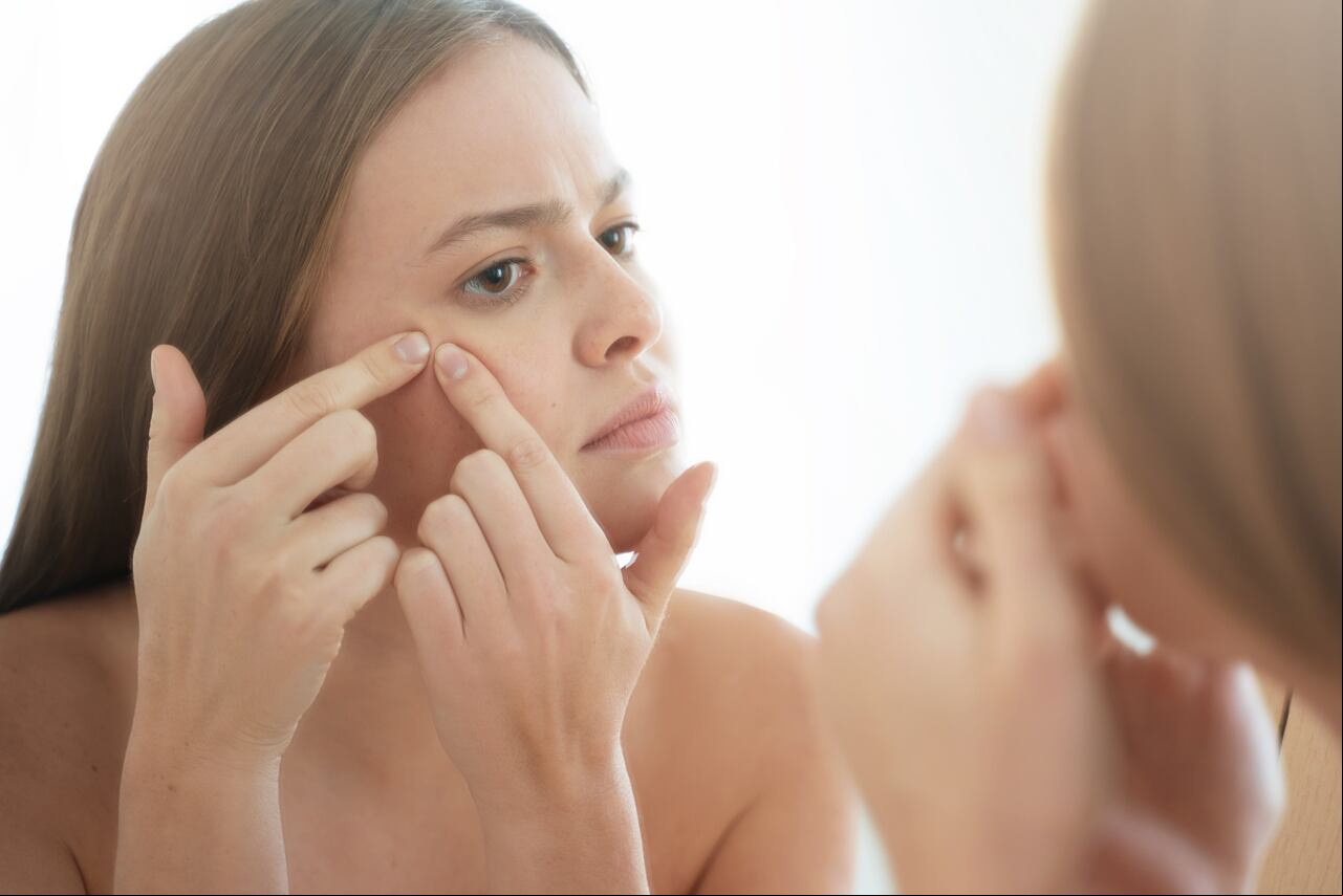 Los dermatólogos ofrecen una guía sobre cómo manejar los barros sin comprometer la piel.