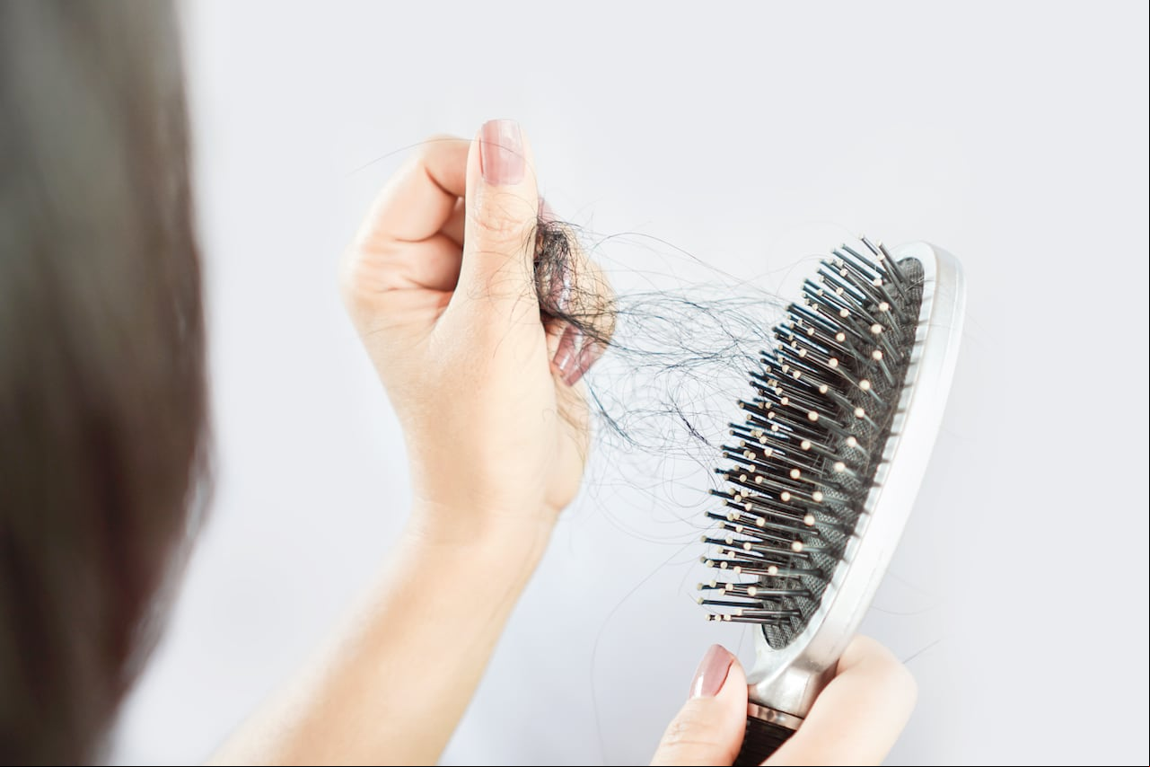 Esta afección puede generar a que el cabello comience a deteriorarse.