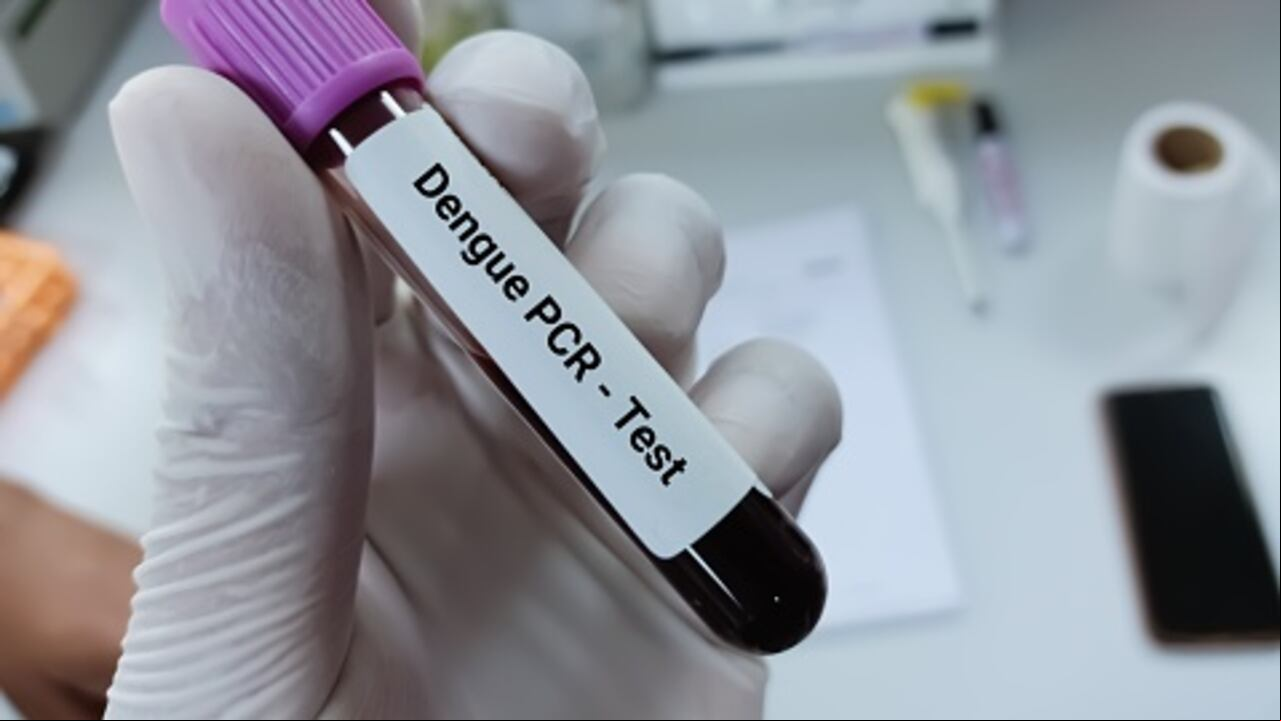 dengue