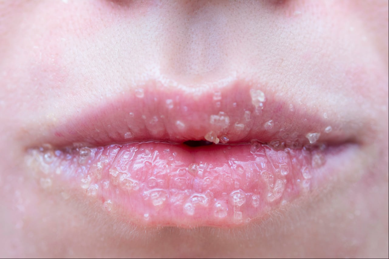 Los métodos caseros y comerciales para la exfoliación labial ofrecen diversas opciones para mantener los labios libres de células muertas y bien hidratados.