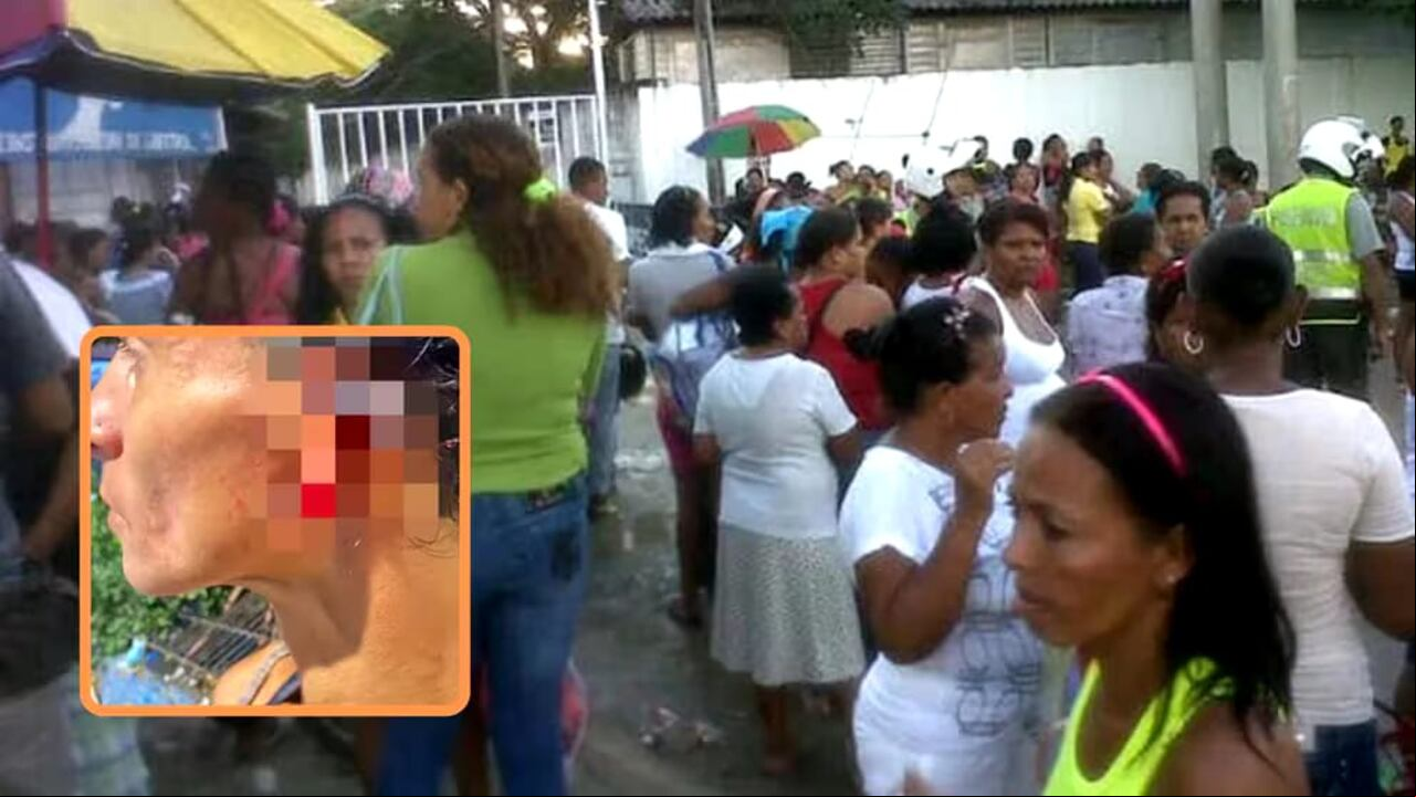 Así quedó la oreja de la afectada.