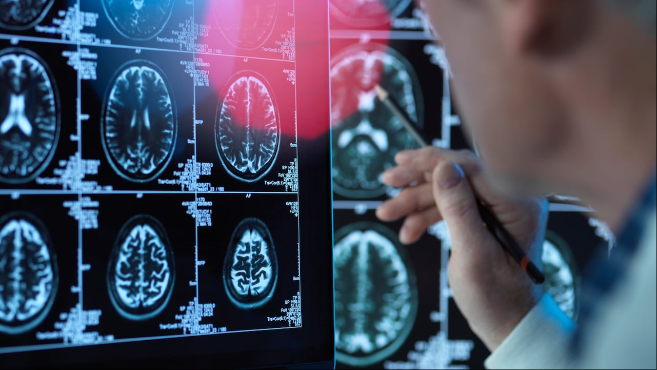 Sistema nervioso - Cerebro