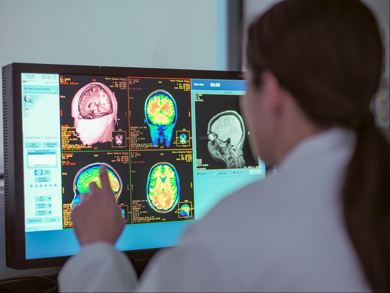 Foto referencia sobre cerebro.