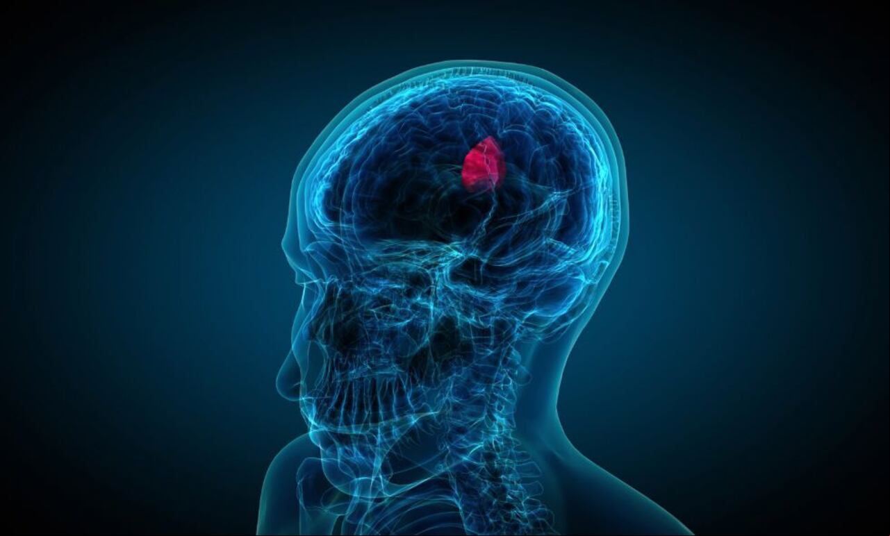 Se espera que la investigación y el desarrollo de terapias dirigidas continúen avanzando, brindando oportunidades para comprender mejor los mecanismos moleculares de los gliomas de grado bajo y desarrollar tratamientos más efectivos y personalizados en el futuro.