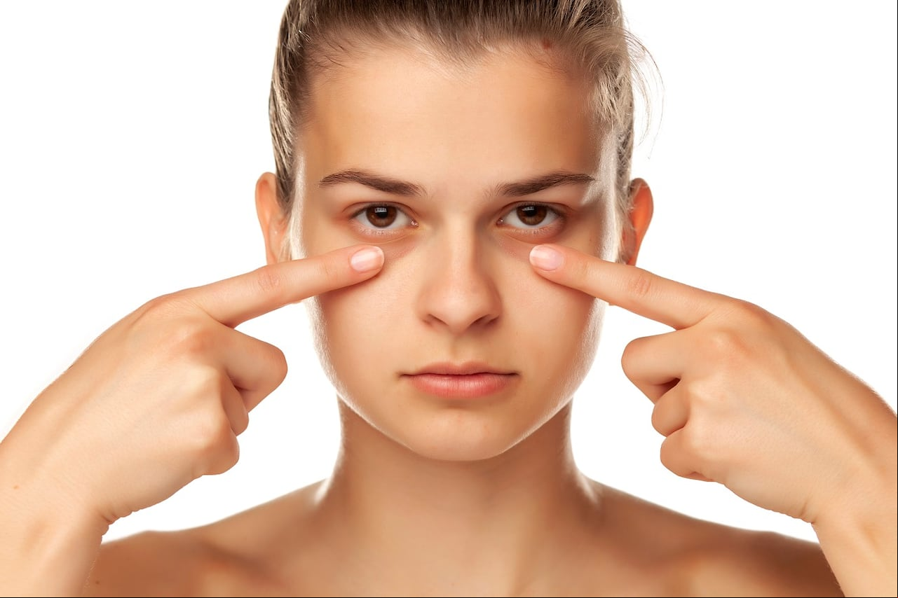 ojeras