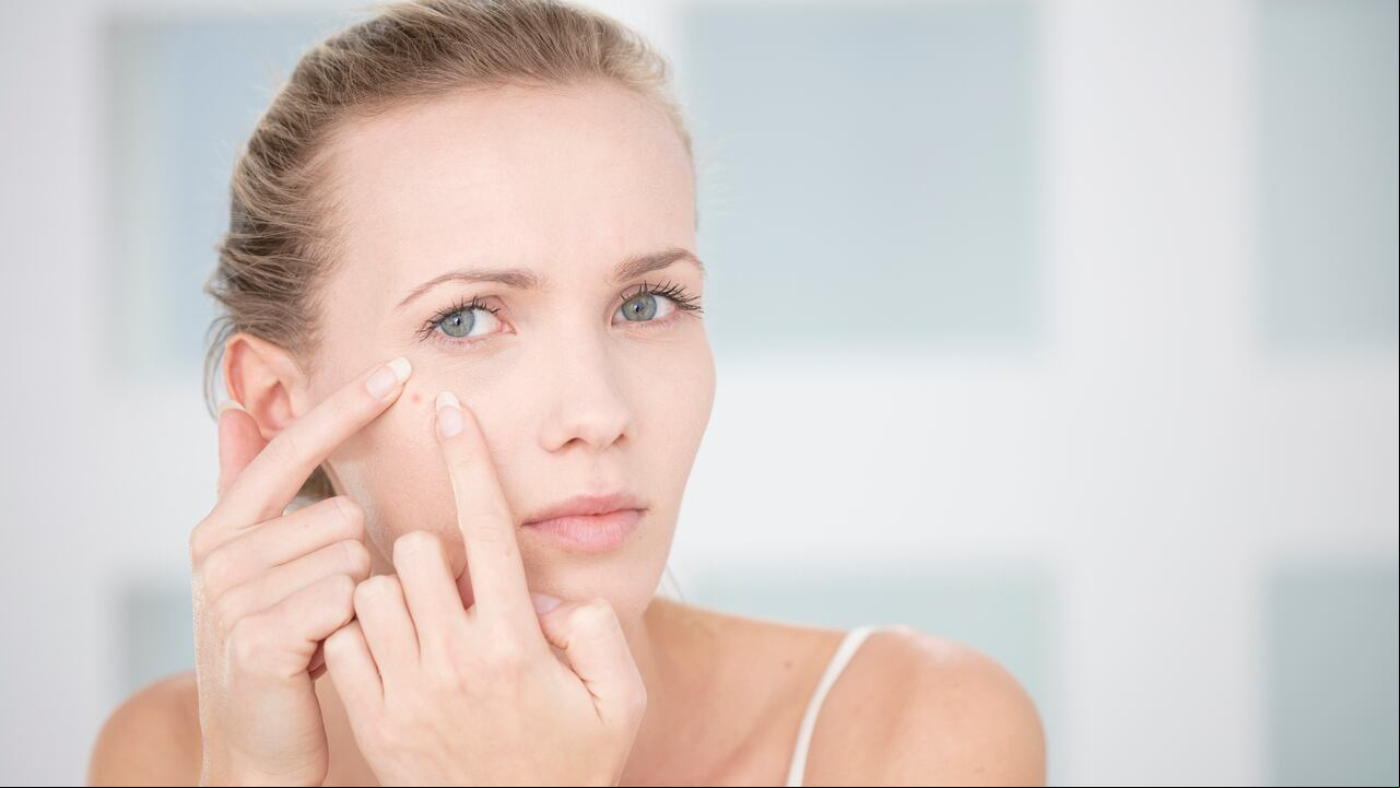Técnicas recomendadas para la extracción de barros son presentadas por dermatólogos.