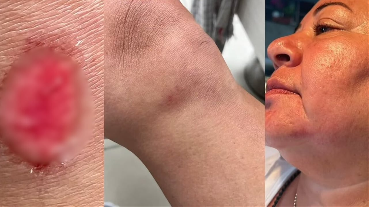 Imágenes de las consecuencias del altercado, compartidas por Blankis Fajardo.