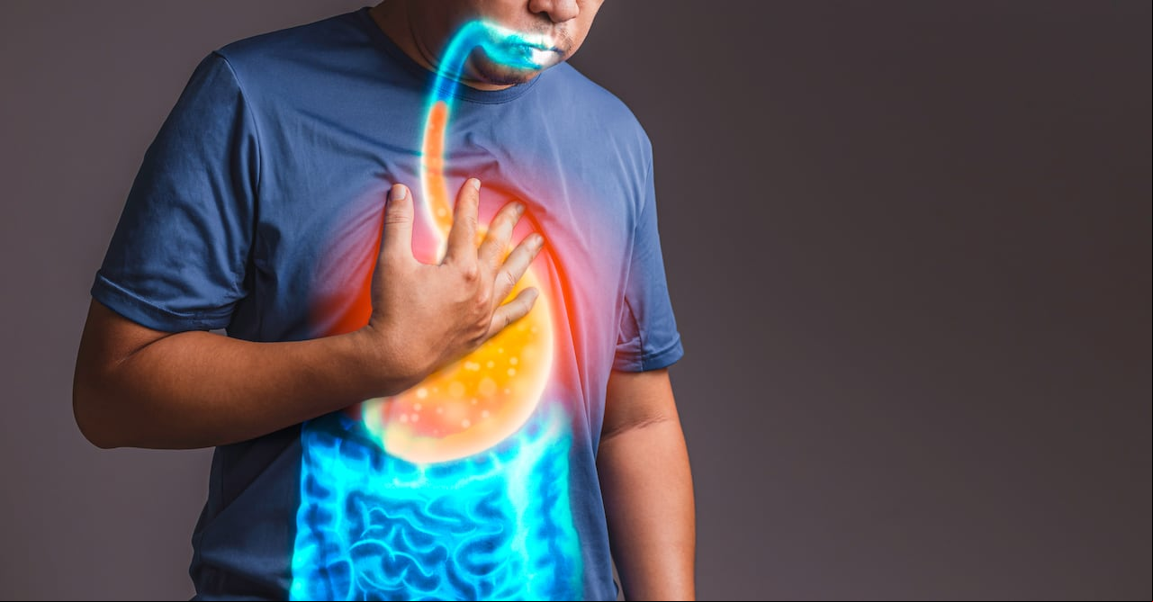 Reflujo gastroesofágico (GERD), acidez estomacal, dolor de estómago, úlceras gástricas, sistema digestivo.