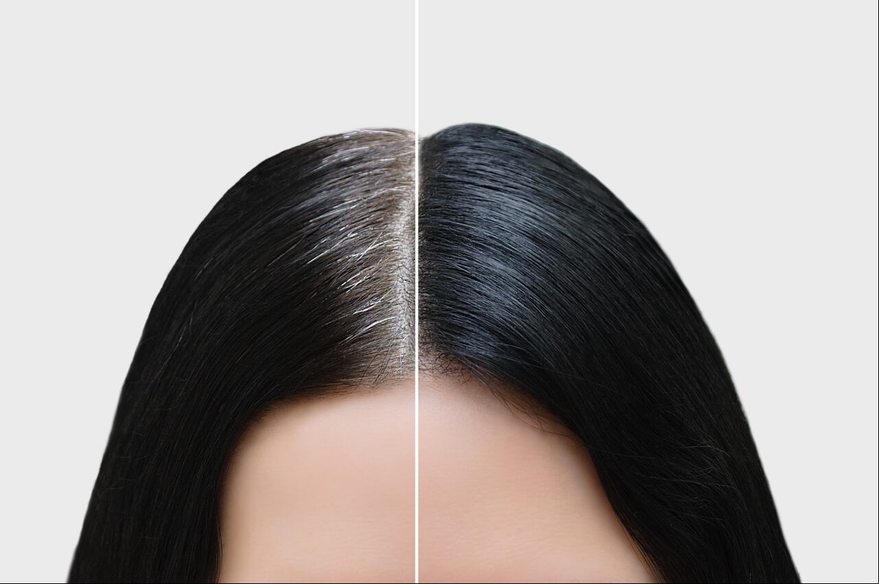 Canas: ¿cómo cubrirlas de forma natural?