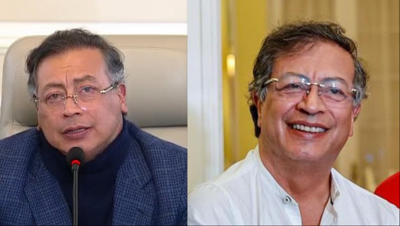 El presidente Petro se sometió a cirugía plástica sin informar al Senado