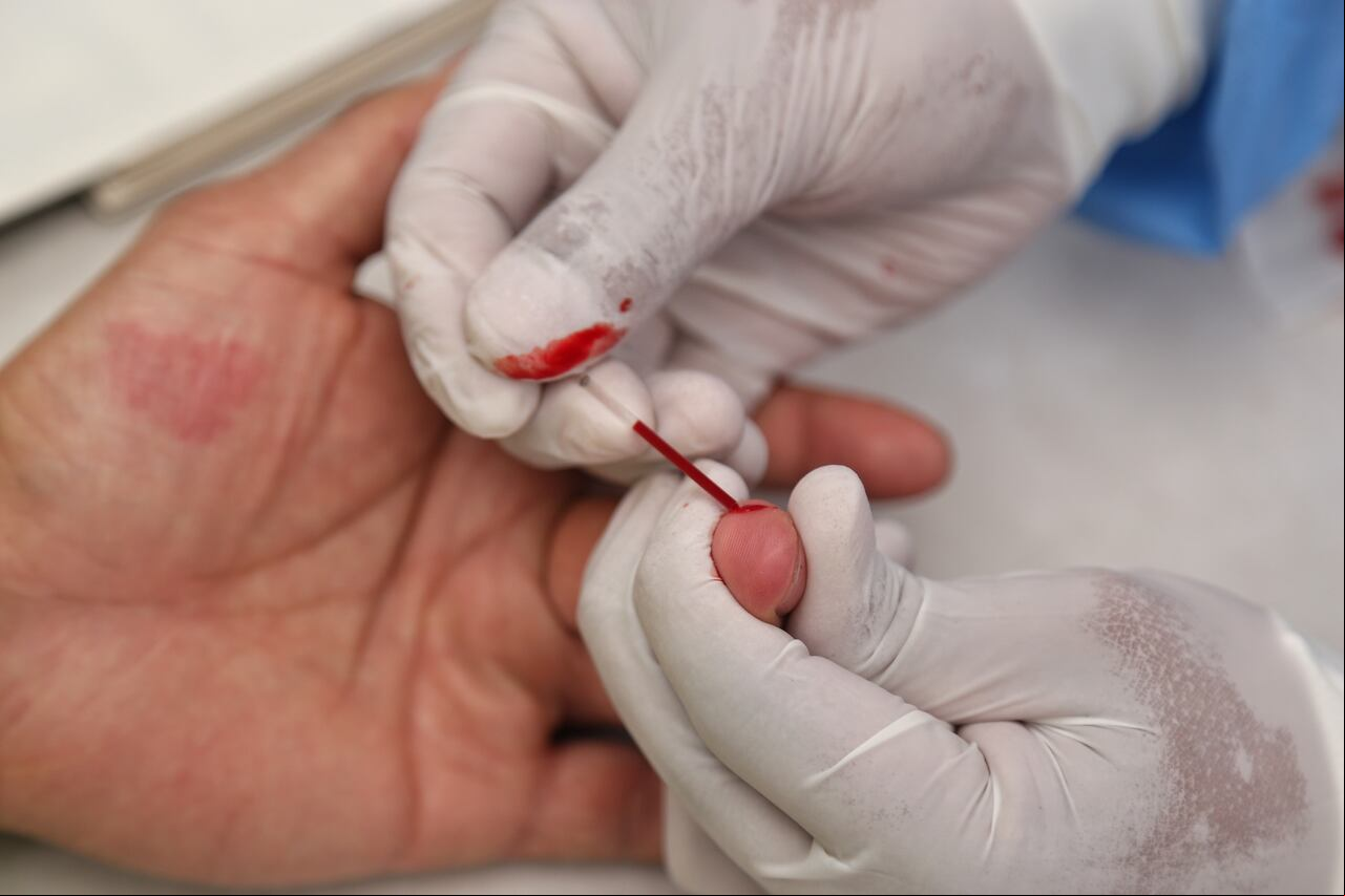 La realización de la prueba del VIH no tarda más de 10 minutos y se hace a través de una muestra de sangre. Las autoridades recomiendan a las personas con vida sexual activa que se la realicen.