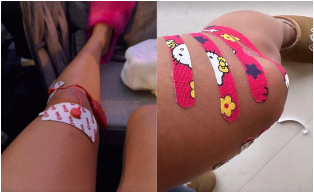 Karol G mostró en sus redes sociales que sufrió una molestia en su rodilla izquierda, tras finalizar su gira de conciertos en México.