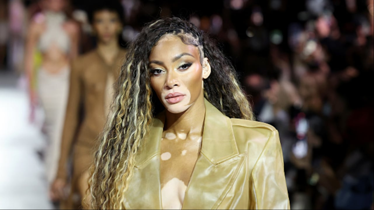Winnie Harlow