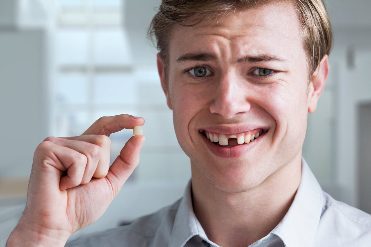 Existe un significado intrigante detrás de los sueños en los que los dientes se desmoronan.