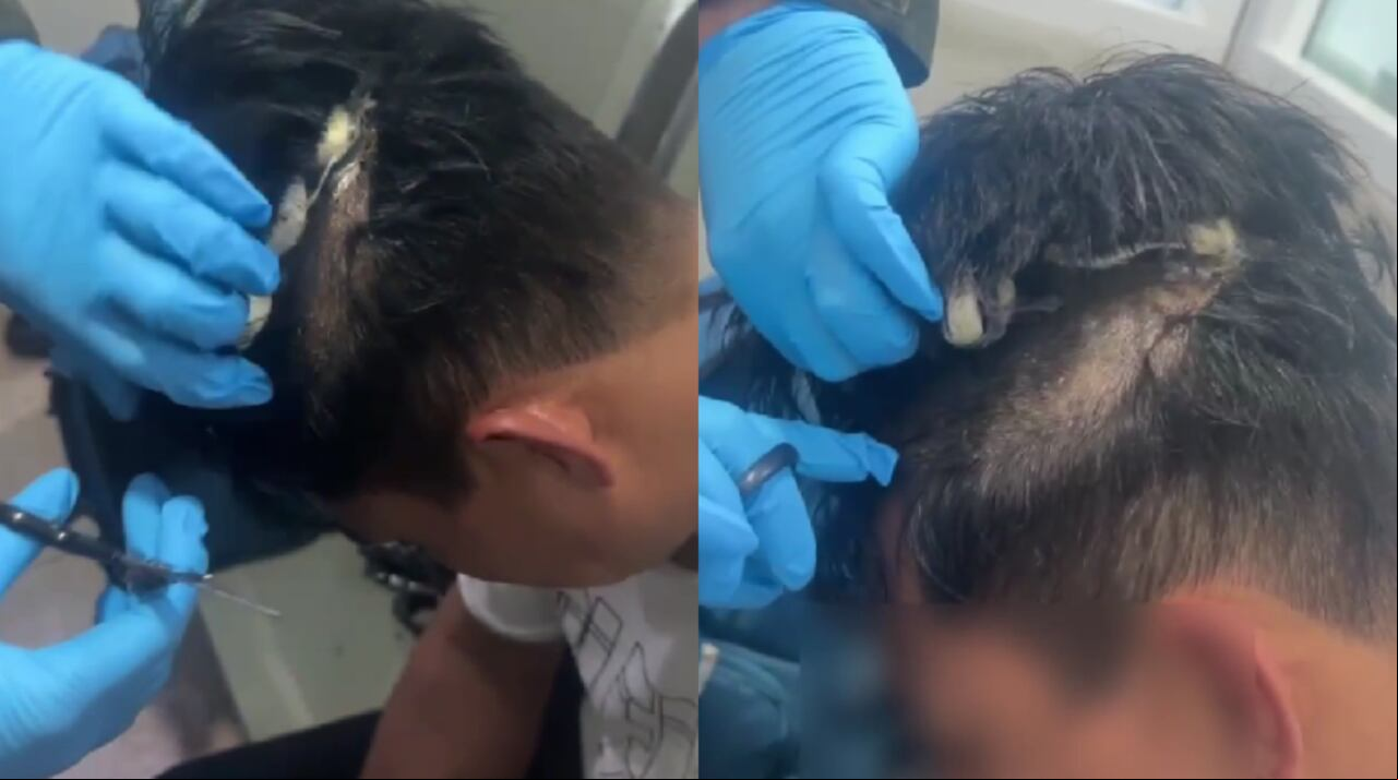 'Narco peluca' hallada en aeropuerto de Cartagena.