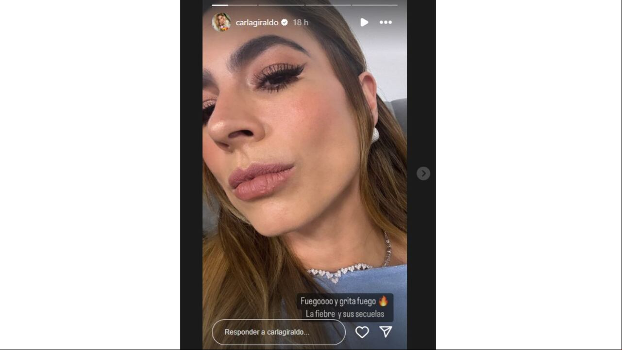 Carla Giraldo mostró las secuelas que sufre tras una afectación de salud que tuvo en medio de su labor en 'La casa de los famosos'