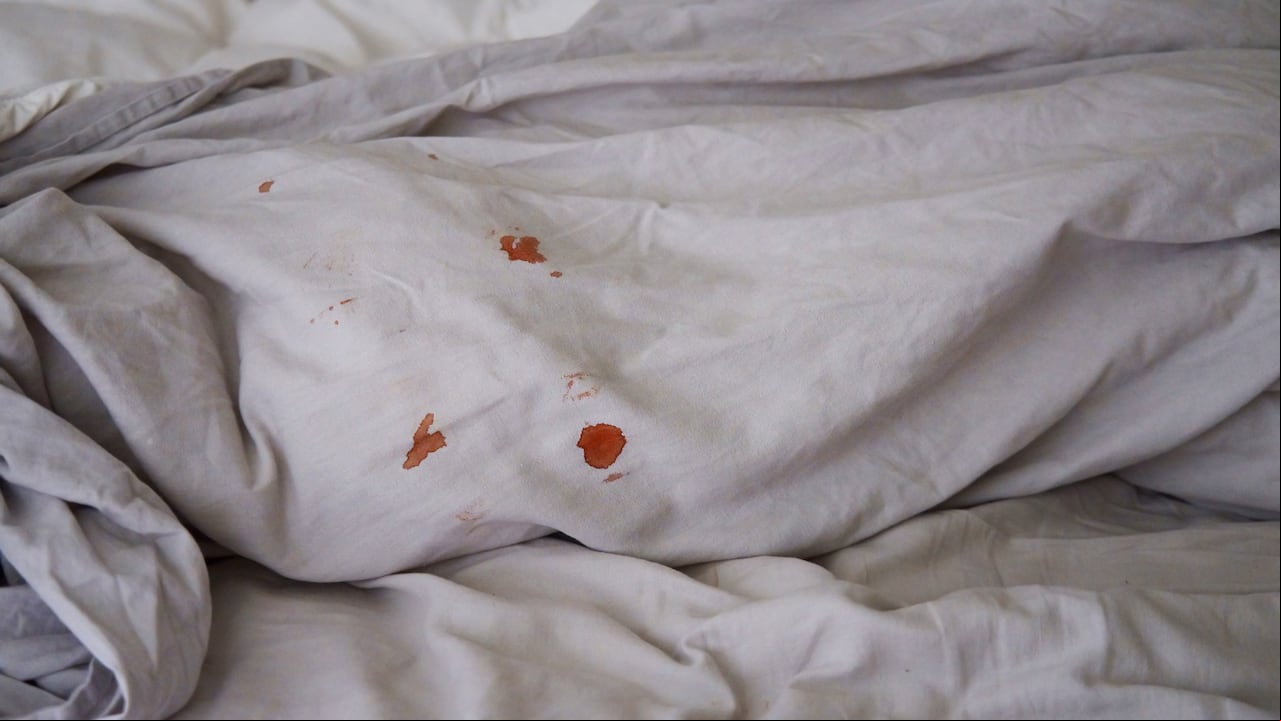 Manchas de sangre