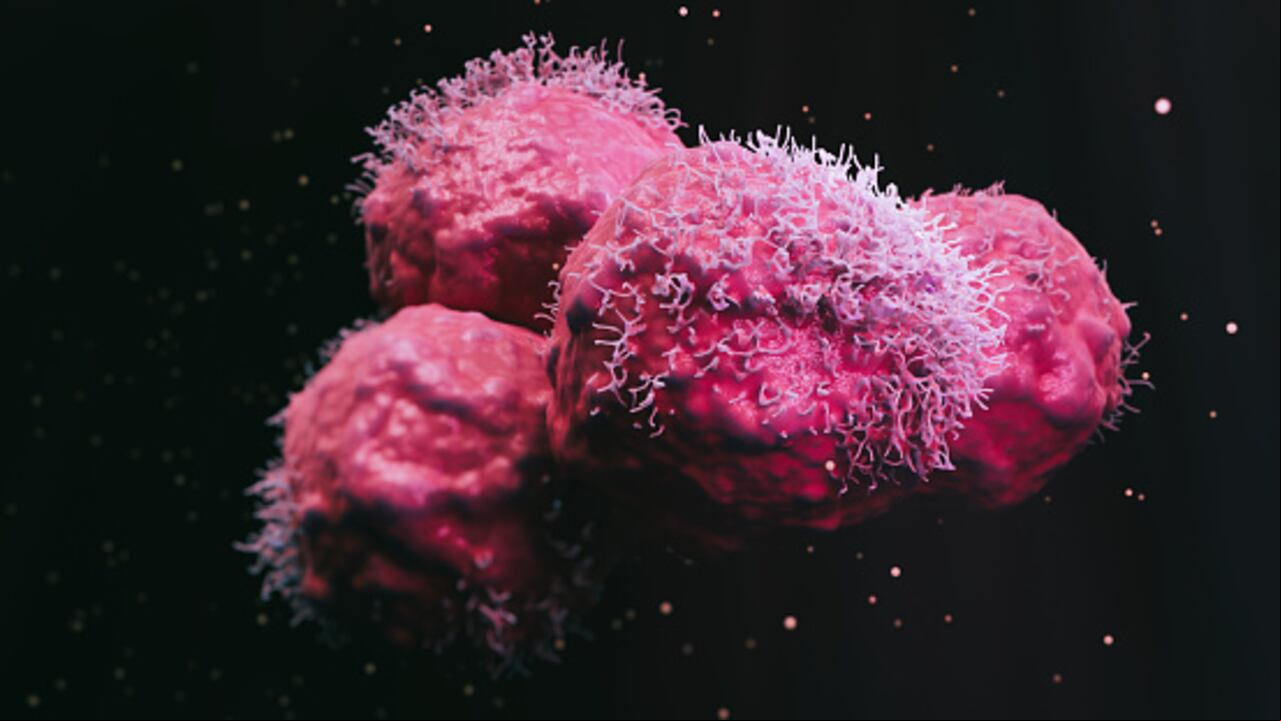 Cancer malignant cells - 3d rendered image, abstract enhanced scanning electron micrograph (SEM) of cancer malignant cells. Visual of overall shape of the cell's surface at a very high magnification. Medical research concept.