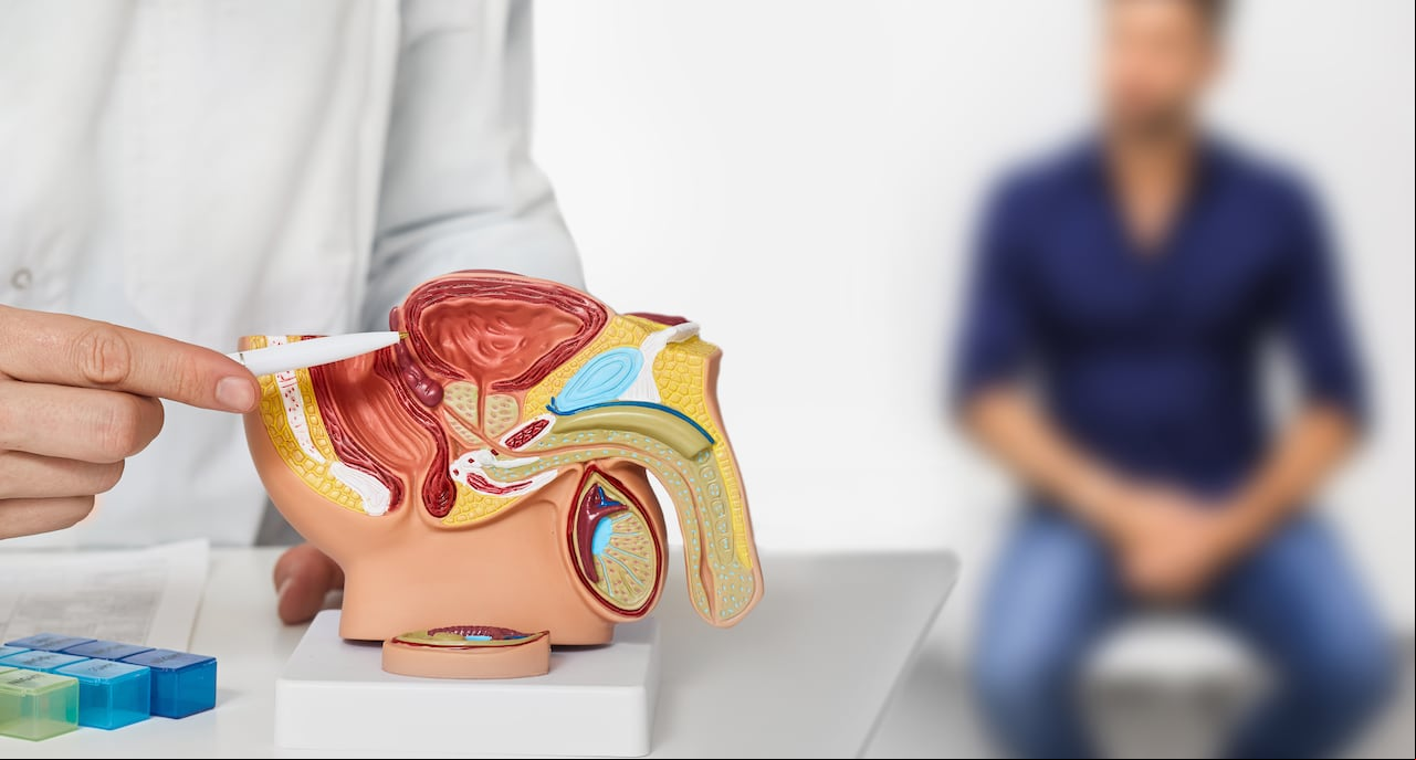 El cáncer de próstata ha teniendo un aumento en la sociedad colombiana desde el 2018.