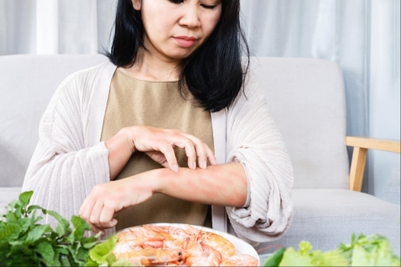 ¿Es posible eliminar las alergias alimentarias sin medicamentos?