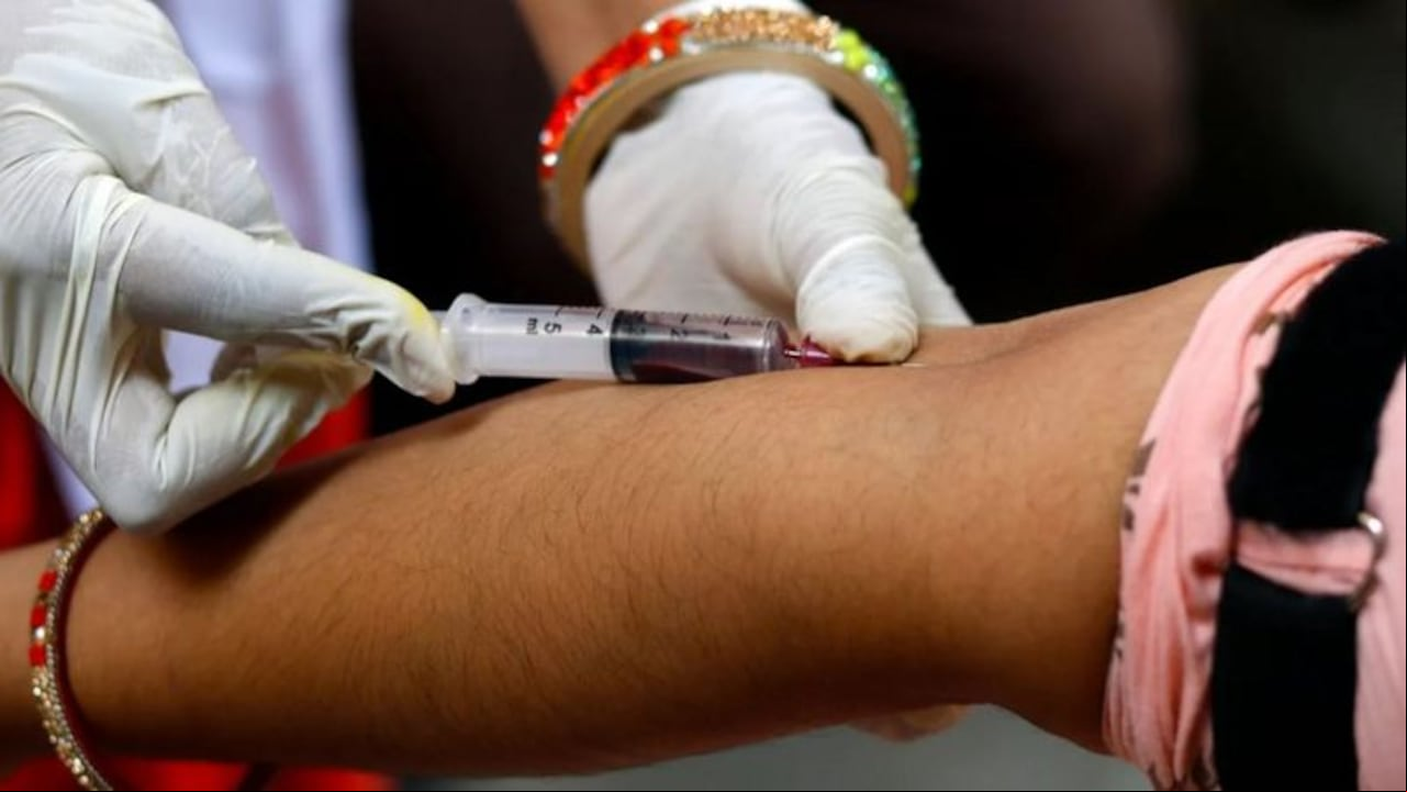 Al comienzo de la pandemia, los médicos comenzaron a notar patrones entre ciertos tipos de sangre de los pacientes y la gravedad de la enfermedad. BBC - GETTY