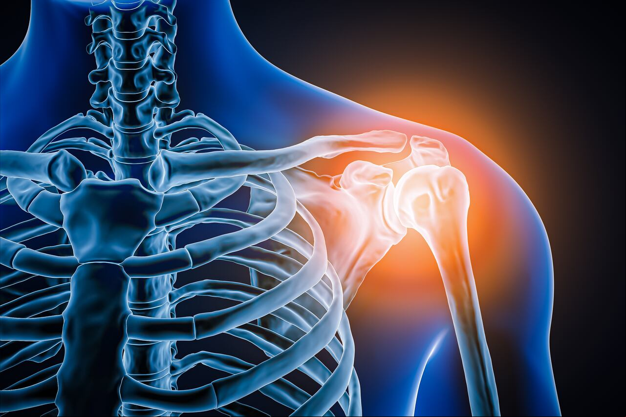 El colágeno ayuda a disminuir el dolor articular y la inflamación en la zona.