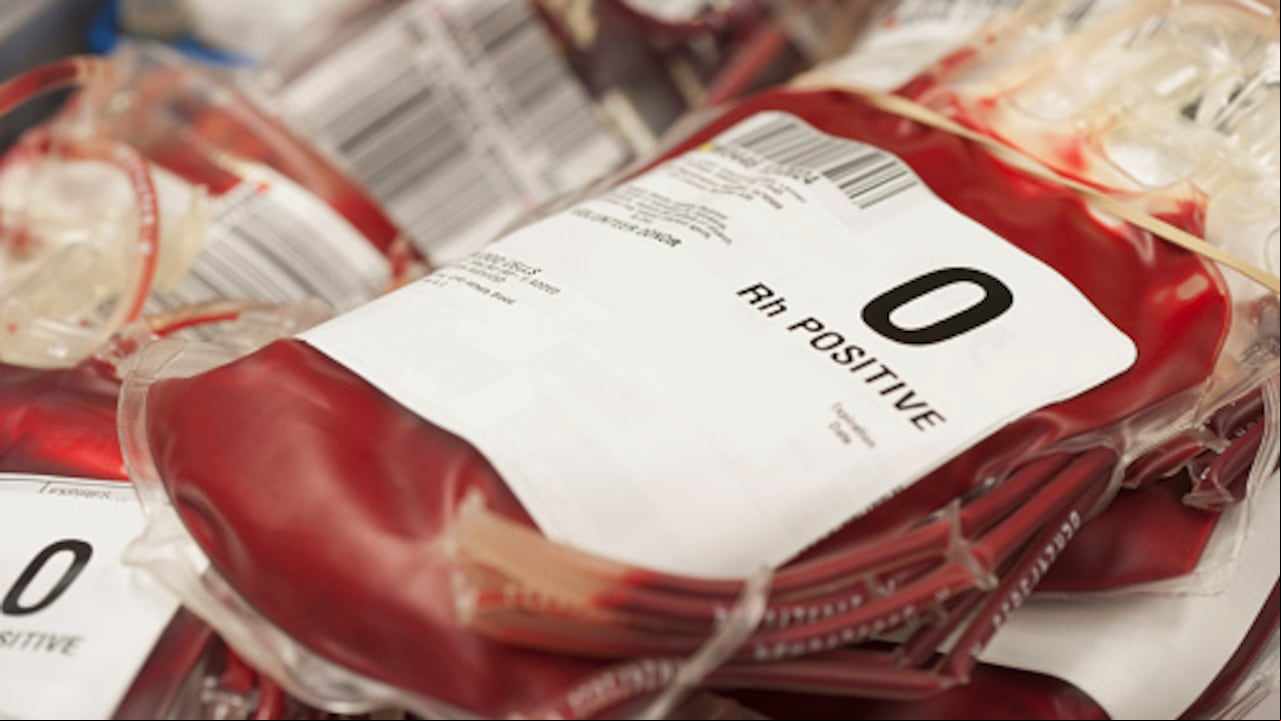 Es importante tener en cuenta, inicialmente, que el grupo sanguíneo es un sistema de clasificación de la sangre humana, que permite que un donante y un receptor sean compatibles en una transfusión de sangre.