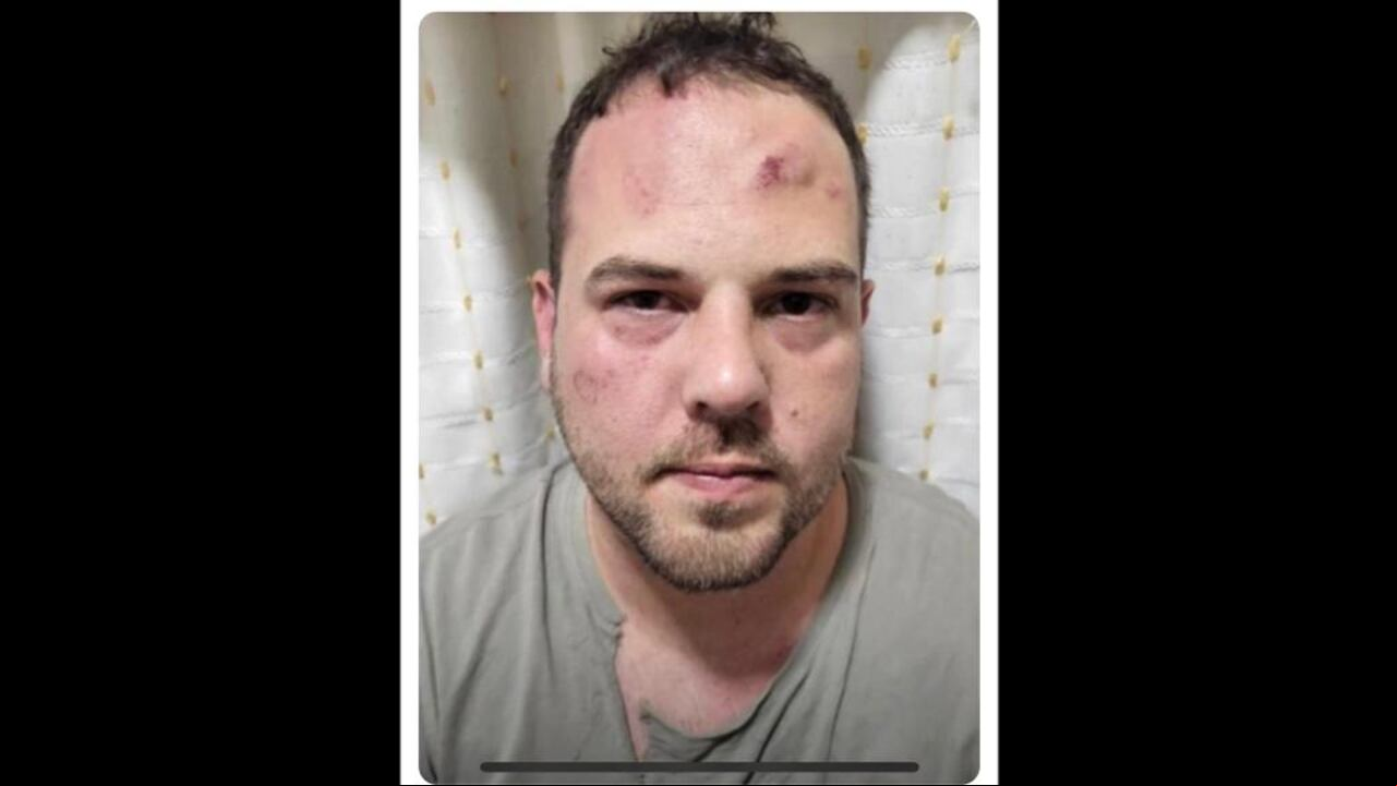 John Poulos, el presunto asesino de la DJ Valentina Trespalacios, habría sido golpeado en la cárcel.